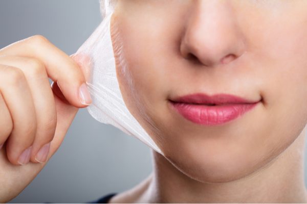 Peeling Químico