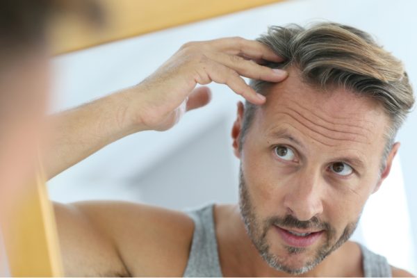 QUEDA DE CABELO – ALOPECIA